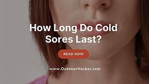 How Long Do Cold Sores Last?