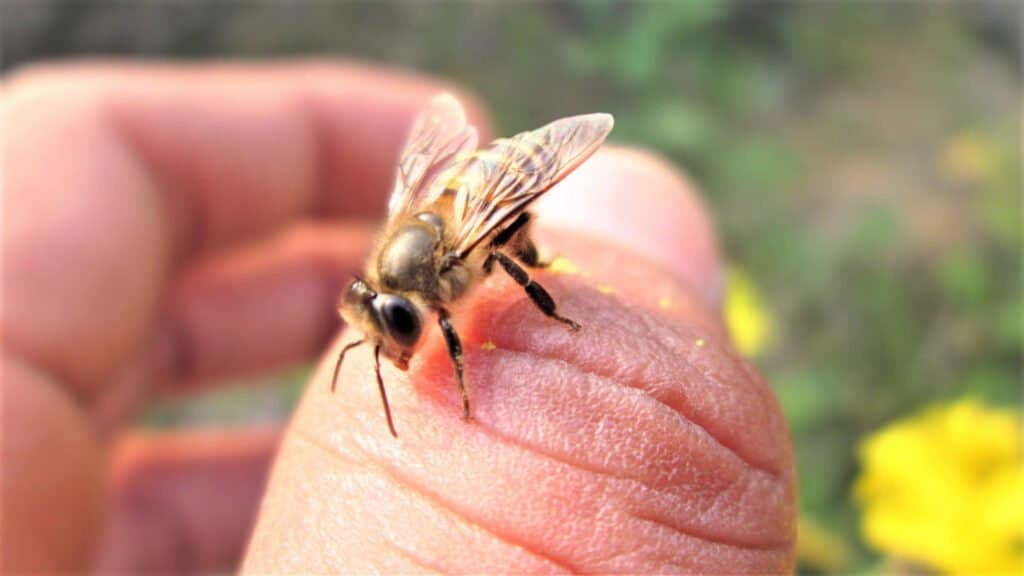 Bee Sting treatment