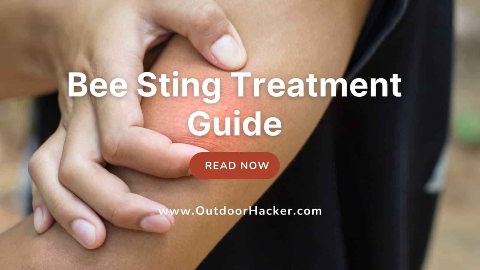 bee sting treatment guide and home remedies